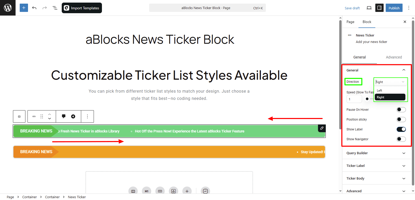 Customize the Content options in the General section.